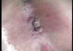 Very close up anal opening